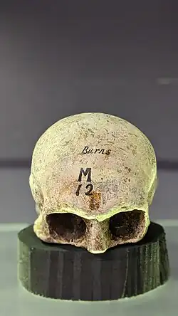 Cast of the skull of Scottish poet Robert Burns after his exhumation in 1834. Held at the Anatomical Museum in Edinburgh, Scotland.