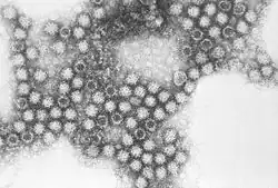 Electron micrograph of Feline calicivirus virions