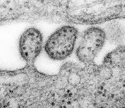 A highly magnified image of a virus alongside cell debris