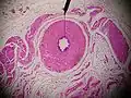 Microscopic cross section.